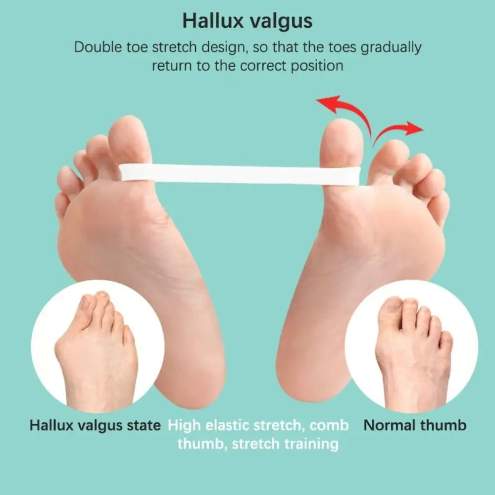 Silicone toe alignment trainer shown on its own