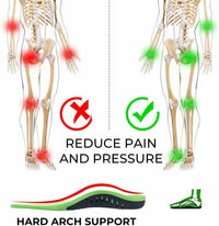 Orthotic Insoles – 3-Point Arch Support for Plantar Fasciitis & Flat Feet