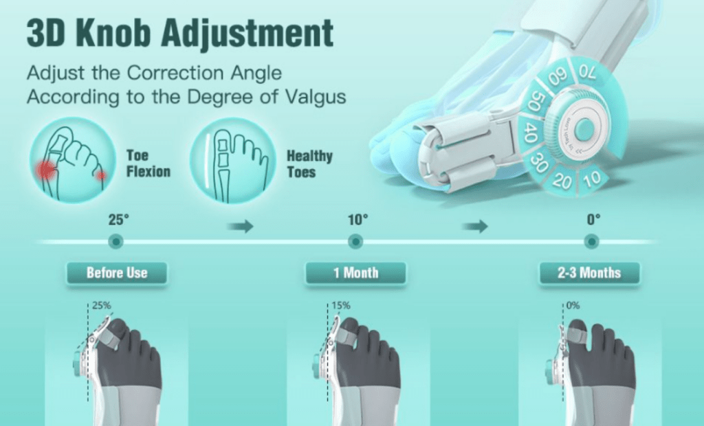 Adjustable Big Toe Brace & Bunion Corrector - Toe Brace - Apex Therapy