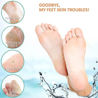 Electric Callus Remover with Vacuum – Rechargeable Foot File - Foot File - Apex Therapy