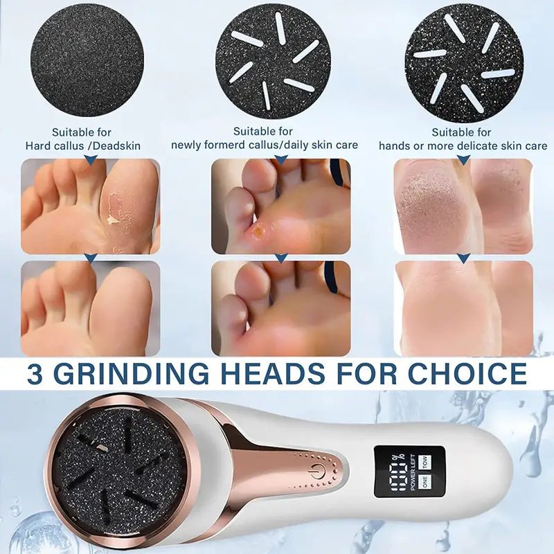 Electric Callus Remover with Vacuum – Rechargeable Foot File - Foot File - Apex Therapy