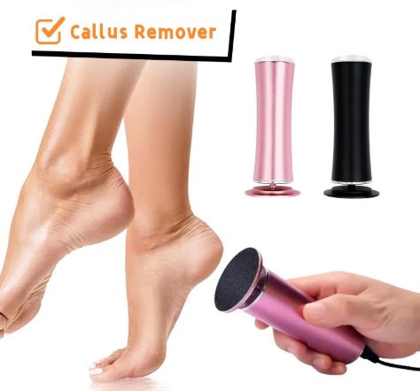 Electric Foot File – 360° Rotating Head, Adjustable Speed - Foot File - Apex Therapy