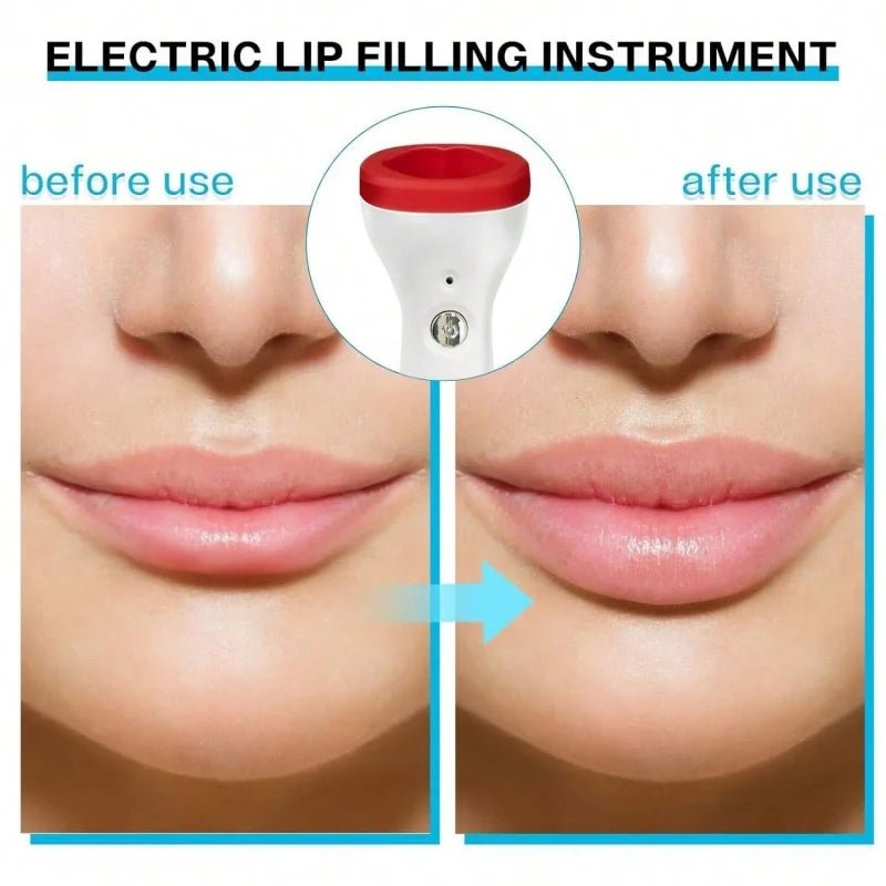 Electric Lip Plumper – Automatic Suction Beauty Tool for Fuller-Looking Lips - Apex Therapy