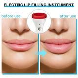 Volumateur de lèvres électrique – Appareil de beauté à aspiration automatique pour des lèvres d’apparence plus pulpeuse