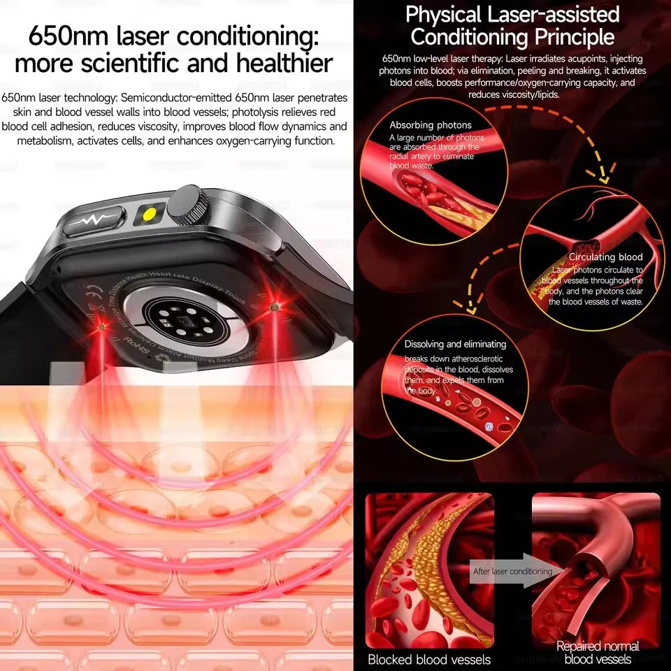 2026Hot AI-GPT Diagosis ECG Health SmartWatch Blood Pressure Lipid Uric Acid 650nm Dual-Probelaser Heart Analysis Smart bracelet