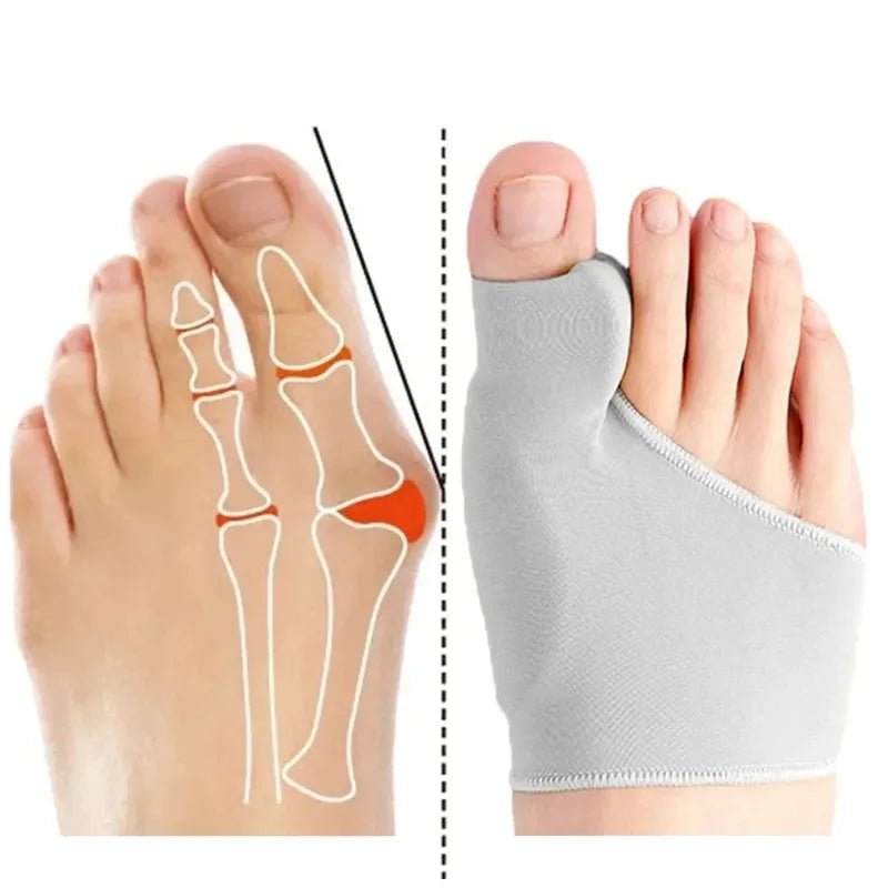 Hallux Valgus Bunion Corrector Orthotics Toe Separator - Feet Bone Thumb Adjuster Pedicure Sock Straightener for Foot Health - Apex Therapy