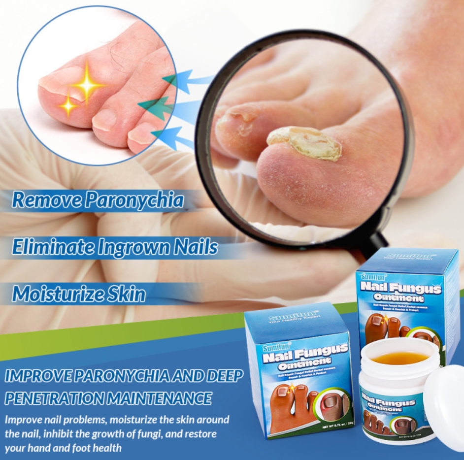 Herbal Foot Cream – Softens Dry, Rough Heels, 20 g - Foot Cream - Apex Therapy