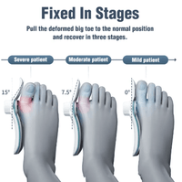 Orthopedic Toe Alignment Brace - Apex Therapy