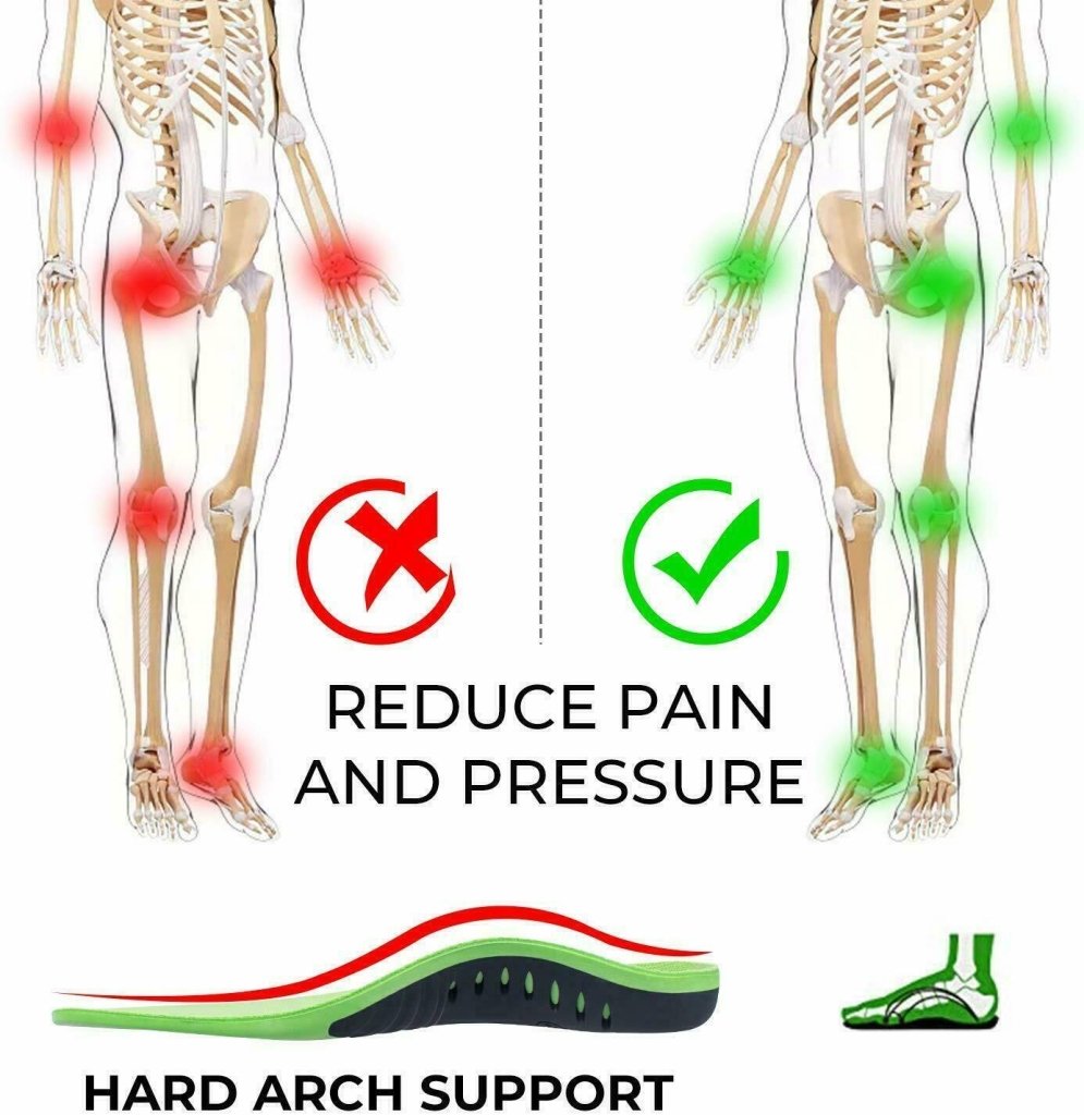 Orthotic Insoles – 3-Point Arch Support for Plantar Fasciitis & Flat Feet - Shoe Insoles - Apex Therapy